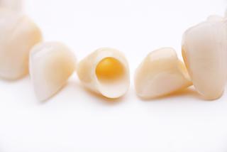 upclose of white dental crowns I CEREC crowns moline il