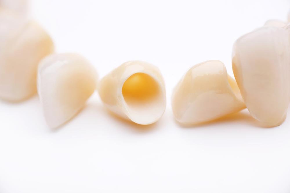 Image of dental crowns in Moline, IL | Quad Cities Dentist