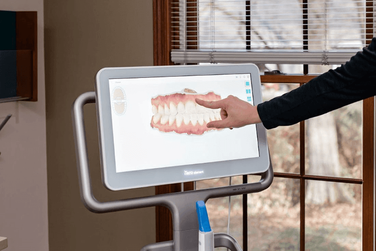 Image of a device used to see close-up imaging of inside a patient's mouth | Moline IL